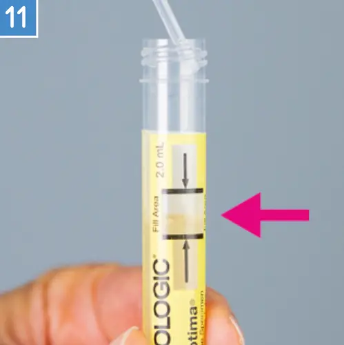Anleitung step 11